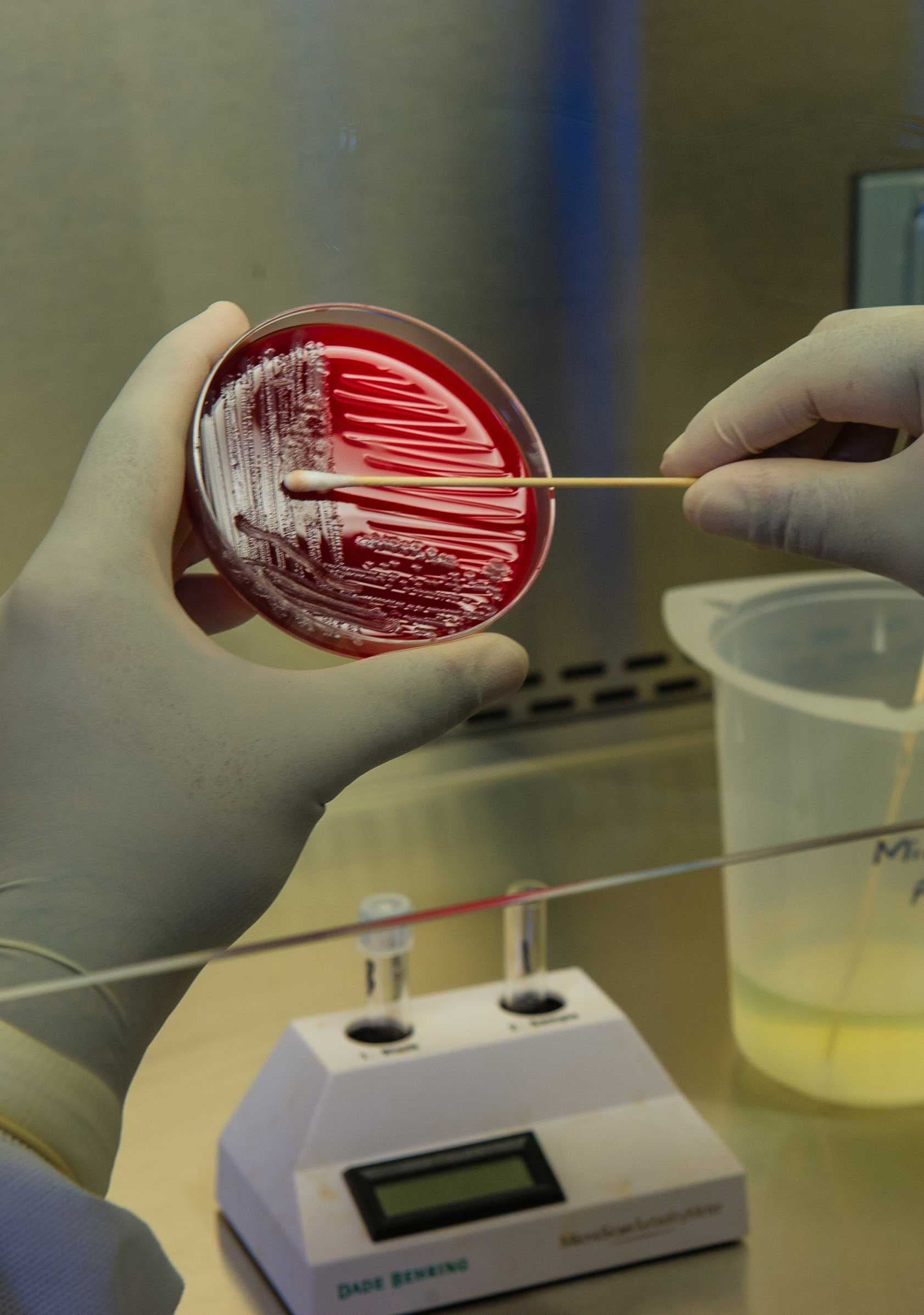 Lab culture work – a petri dish being handled in a sterile environment, representing strain engineering and quality control